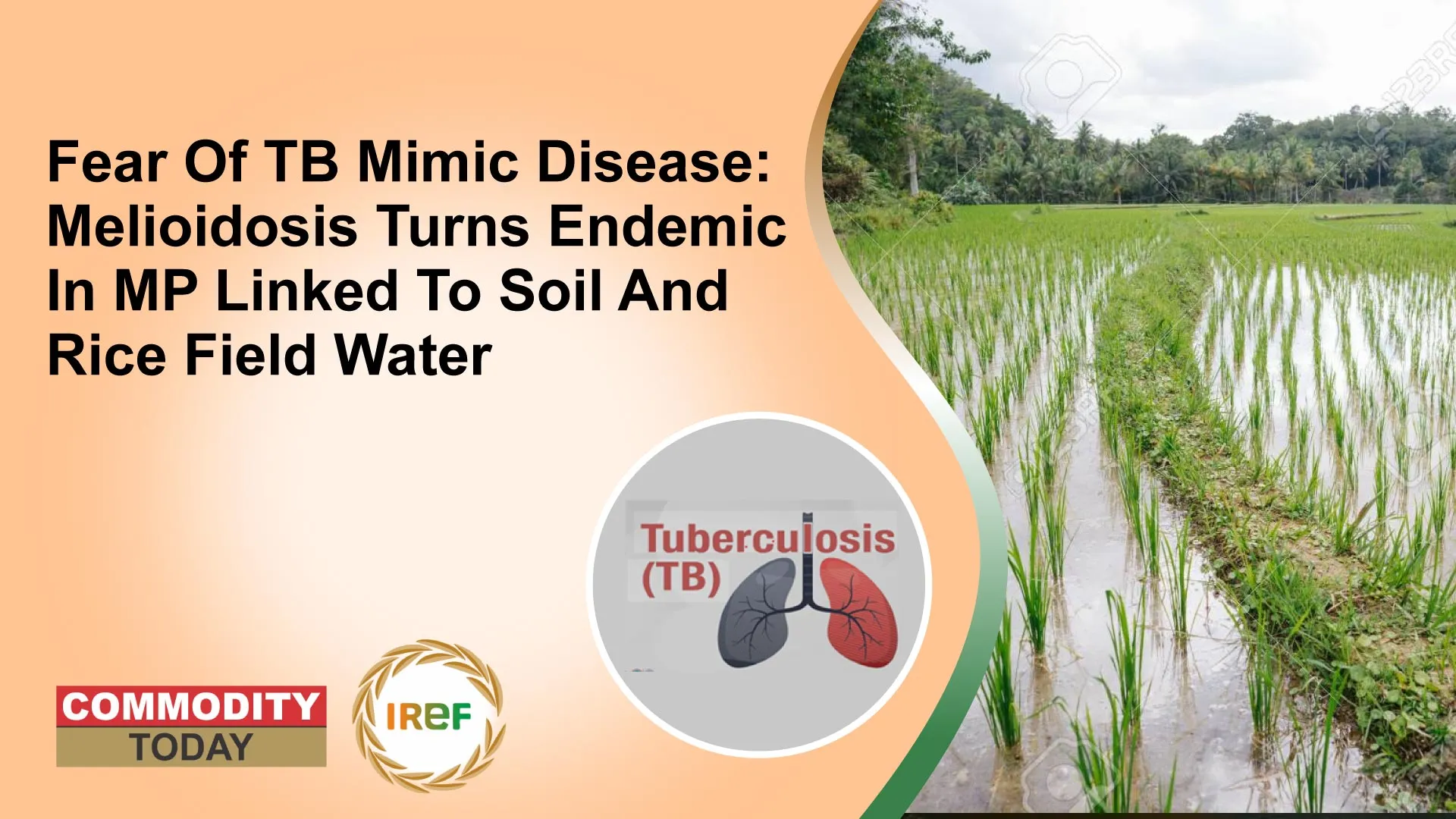 Fear Of TB Mimic Disease: Melioidosis Turns Endemic In MP Linked To Soil And Rice Field Water
