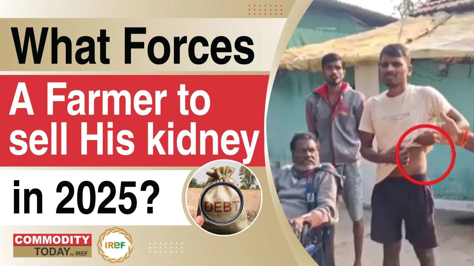Debt and Despair: Maharashtra Farmer Sells Kidney to Repay Debt in 2025